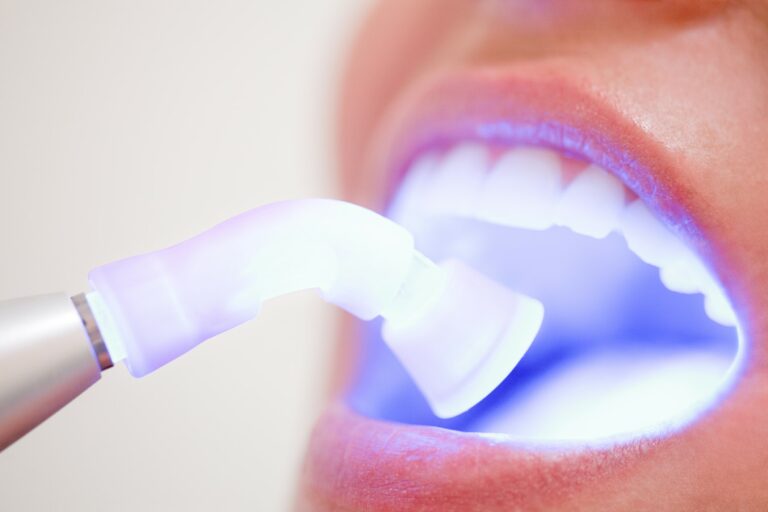 laser in patients mouth