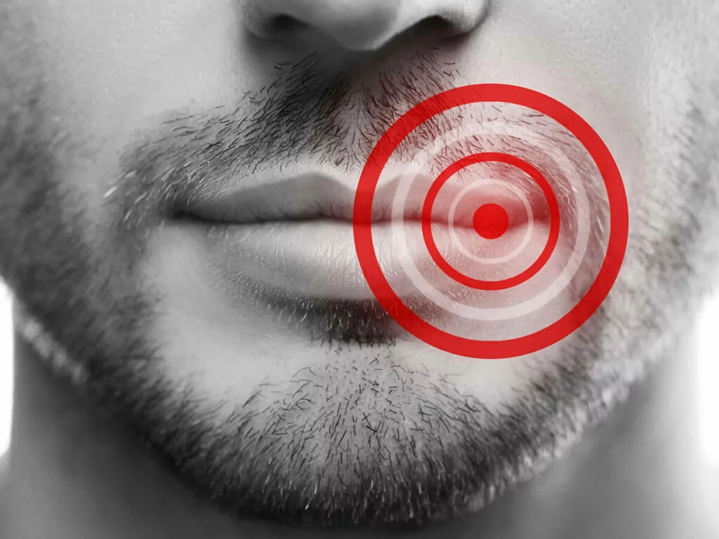 Close-up of a person's lower face with lips slightly parted and a red target-like graphic overlay on the right side of the lips.